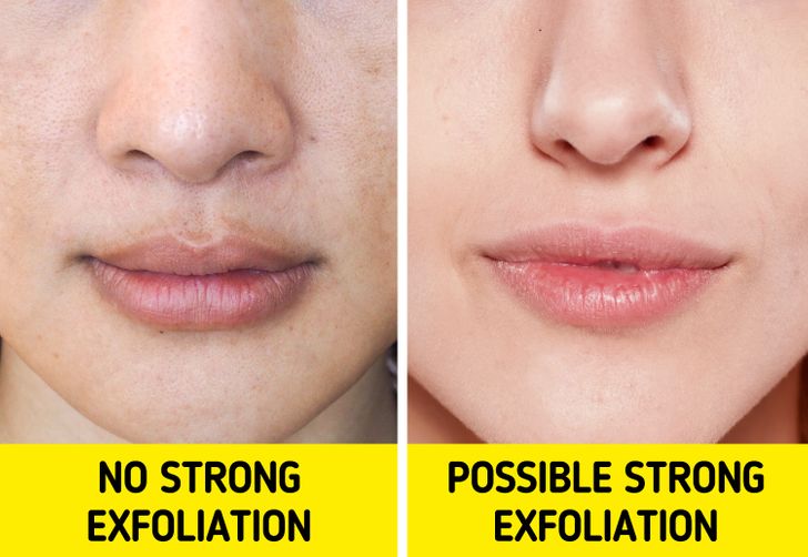 Bác sĩ da liễu chỉ ra 8 điều nên làm khi gặp tình trạng lỗ chân lông to và dầu nhờn tiết nhiều-8