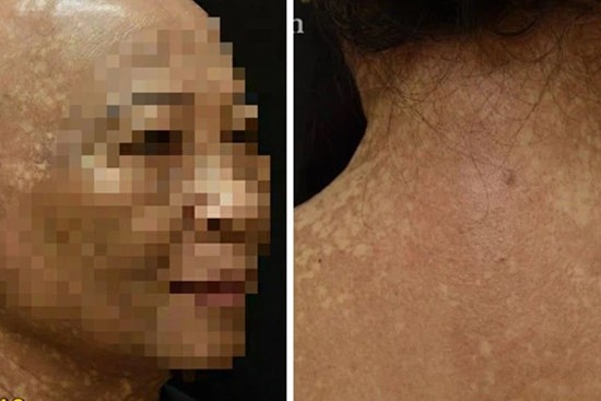 Người phụ nữ 7 năm trời hóa