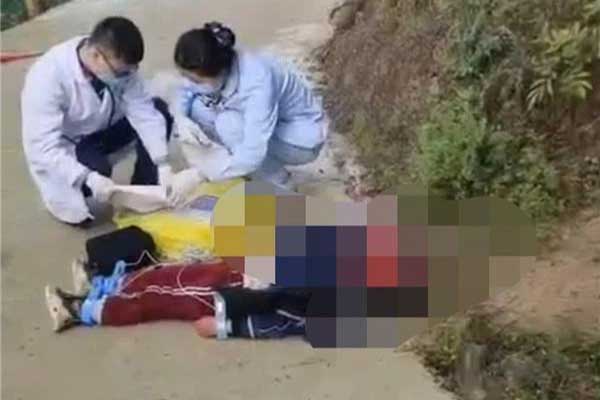 Clip: Chó điên bất ngờ lao vào tấn công người đi đường, 21 người phải nhập viện, nạn nhân nhỏ nhất chỉ mới 3 tuổi-2