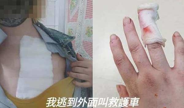 Vừa tố mẹ chồng cắn và tạt dầu ớt, cựu tiếp viên hàng không bỗng châm lửa đốt chết chồng, hé lộ tình tiết giật gân làm dư luận choáng váng-4