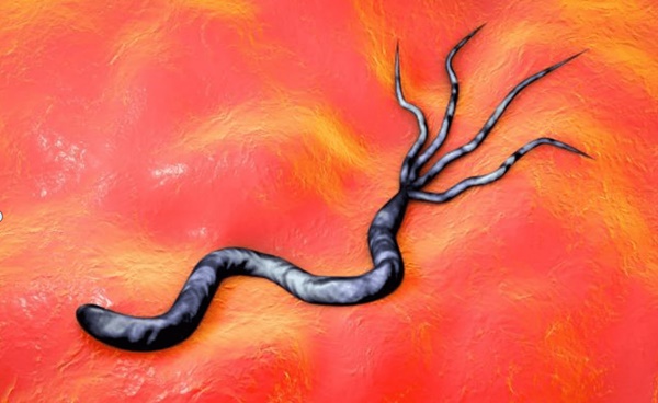 Bụng chứa nhiều vi khuẩn gây ung thư dạ dày sẽ gây ra 4 triệu chứng khó chịu, đừng bỏ qua kẻo hối hận-2