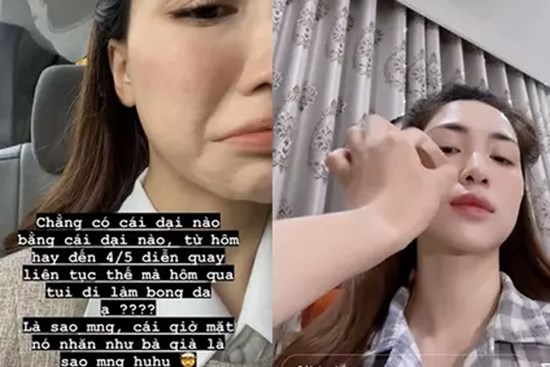 Hòa Minzy muốn 'trầm cảm' vì da dẻ bong tróc thành từng mảng