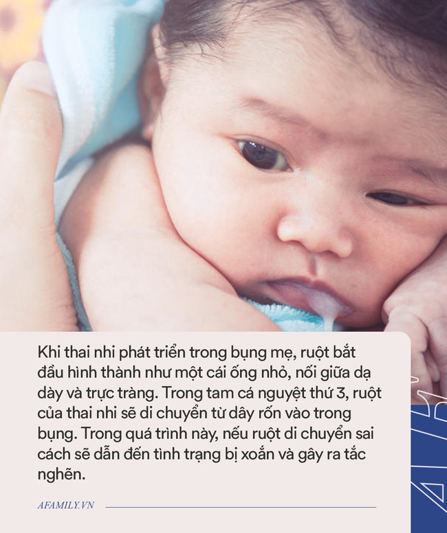 Bé 1 tuần tuổi trớ ra sữa màu xanh, bà mẹ đưa con đi khám rồi chết lặng khi bác sĩ báo hãy chuẩn bị tinh thần-3