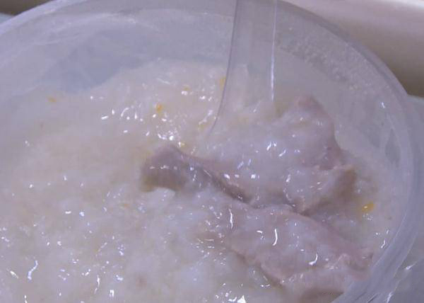 Đưa con đi khám vì đang ăn cháo bỗng ho liên tục, bà mẹ sợ tái mặt khi nhìn vào phim chụp X-quang-1