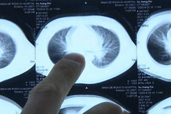 Mẹ xuống nhà lấy đồ nên nhờ con gái 4 tuổi trông em, không ngờ lại chứng kiến được cảnh tượng gây choáng váng-5