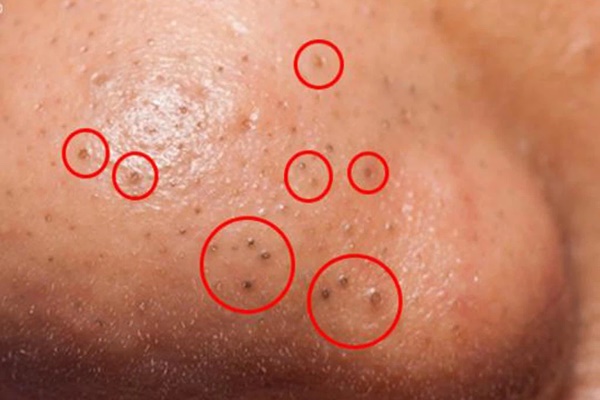 3 điều khiến bạn già hơn hẳn so với tuổi, mà chỉ xuất phát từ một nguyên nhân duy nhất-2