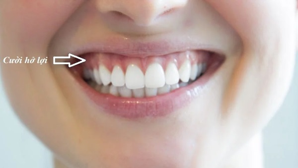 Cổ nhân dạy: Phụ nữ xinh đẹp đến mấy nhưng có 7 nét tướng này lận đận tình duyên, dễ hai lần đò-1