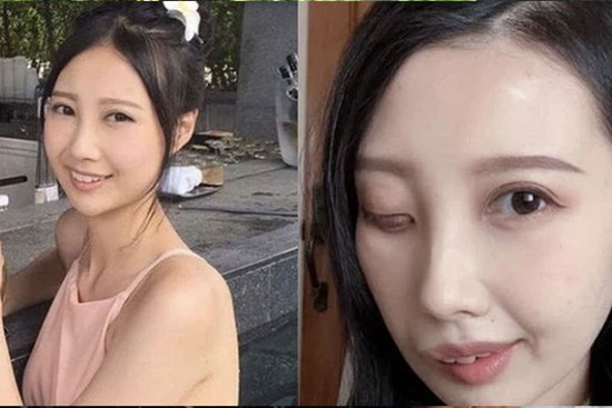 9 năm chiến đấu với bệnh ung thư hiếm gặp, nữ ca sĩ đã trút hơi thở cuối cùng ở tuổi 31 với gương mặt biến dạng
