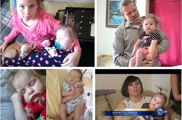 Bị sét đánh trúng khi đang mang thai tháng cuối, sản phụ được đưa vào viện cấp cứu và hình hài của đứa trẻ khiến ekip mổ choáng váng-6