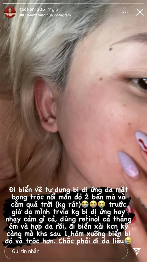 Tóc Tiên toang hết mặt sau khi đi biển và cách phục hồi da-1