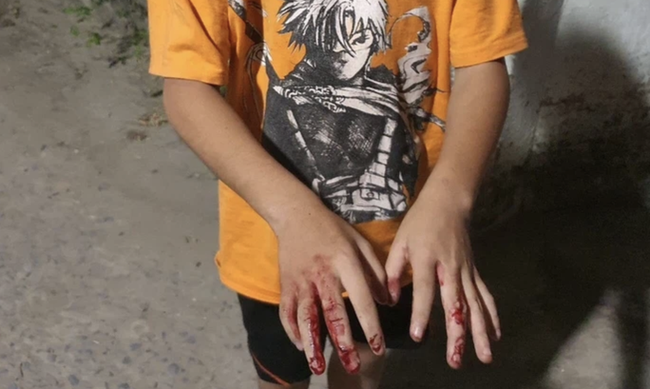 Mẹ bé trai 11 tuổi ở TP.HCM bị cha đánh nát tay bắt đi bán vé số lên tiếng: Nó là đứa được cha cưng chiều nhất, nhưng cũng vì vậy mà sinh hư-1