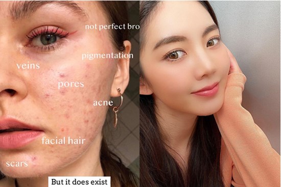 Dùng BHA + Niacinamide: Công thức chuẩn giúp thu nhỏ lỗ chân lông, da dẻ mịn màng láng căng