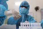 Hà Nam: Nữ nhân viên chùa Tam Chúc được phát hiện dương tính SARS-CoV-2 ở Bệnh viện K cơ sở Tân Triều-1
