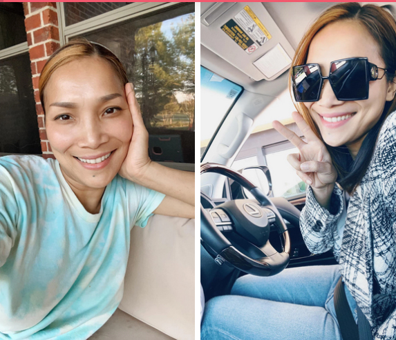 Cận cảnh gương mặt Hồng Ngọc sau 1 năm bị bỏng nặng-1