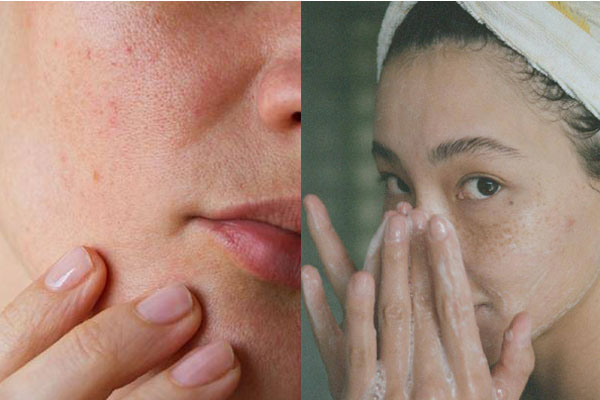 Bác sĩ lưu ý 4 điều để chị em chọn được sữa rửa mặt chuẩn nhất, giúp da đẹp lên từ bước làm sạch-4