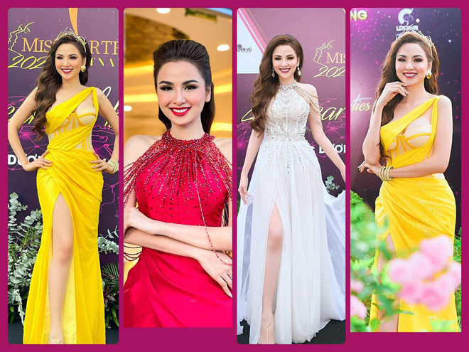 Hoa hậu Diễm Hương: Tôi bị bệnh hiếm, căn bệnh mà 10.000 người mới có 1 người bị-1