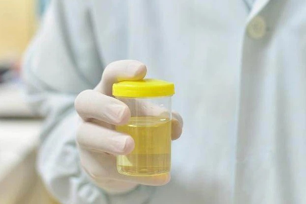 Sáng ngủ dậy, nước tiểu của nam giới có 3 đặc điểm sau thì xin chúc mừng vì thận đang rất khỏe mạnh đó-1