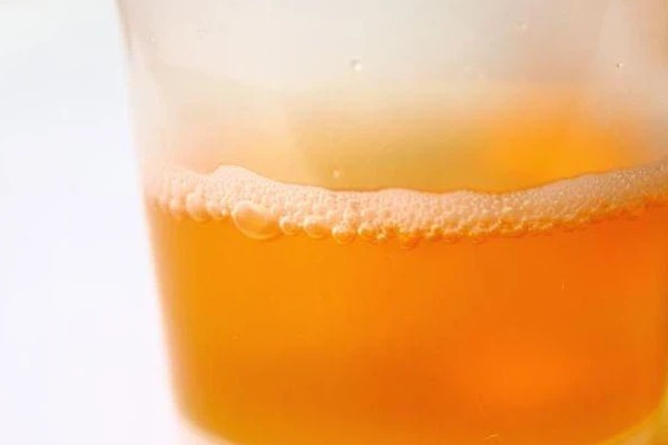 Sáng ngủ dậy, nước tiểu của nam giới có 3 đặc điểm sau thì xin chúc mừng vì thận đang rất khỏe mạnh đó-2