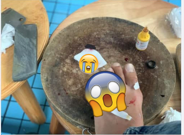 Buồn chuyện tình cảm, nam thanh niên livestream lấy dao chặt phăng ngón chân-2