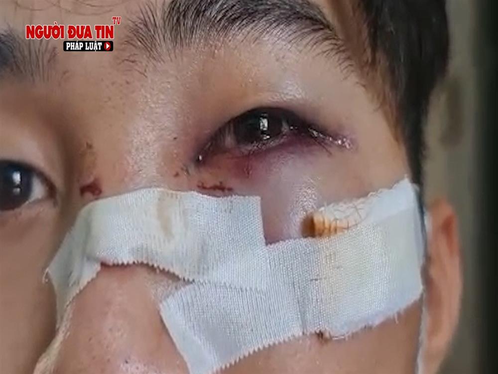 Hà Nội: Truy tìm đối tượng dùng vật nghi súng tấn công người đi đường rồi bỏ chạy-4