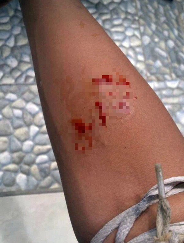 Hào hứng chụp ảnh cùng bé Na, thiếu niên không để ý đến chi tiết chết người để rồi hứng trọn hậu quả trong bức ảnh tiếp theo đăng lên MXH-2