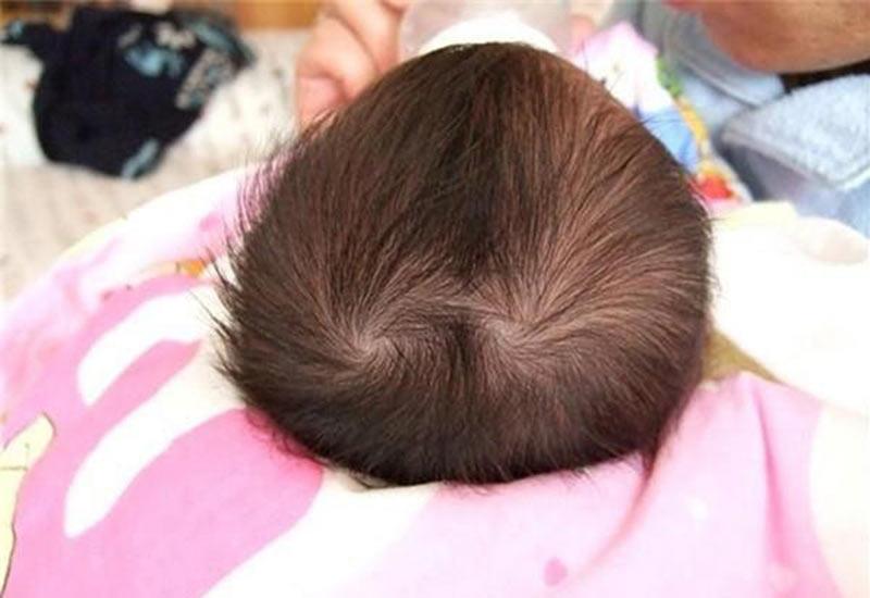 Số lượng xoáy tóc trên đầu trẻ tượng trưng cho điều gì? Trẻ có nhiều xoáy thường thông mình, nhiều tài lẻ có đúng như mọi người thường nói?-3