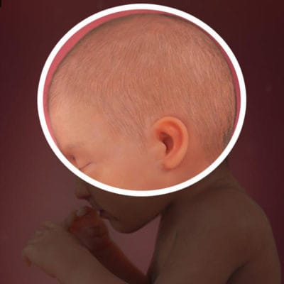 Số lượng xoáy tóc trên đầu trẻ tượng trưng cho điều gì? Trẻ có nhiều xoáy thường thông mình, nhiều tài lẻ&nbsp;có đúng như mọi người thường nói?-2