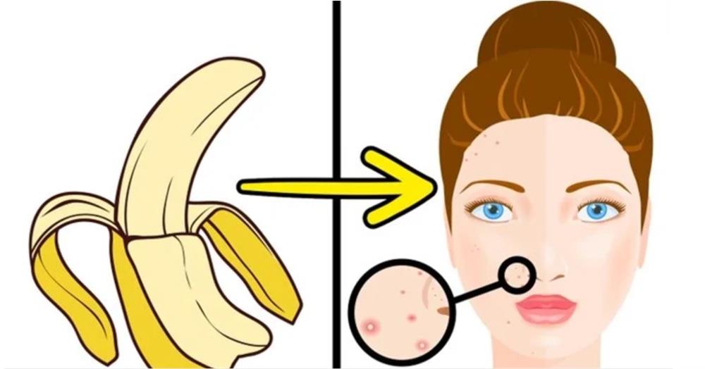 Vô tình đánh rơi vỏ chuối vào chậu nước, ai ngờ phát hiện ra điều lạ-2