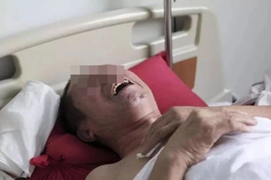 Người đàn ông đau vai suốt 1 năm được chẩn đoán mắc ung thư gan, bác sĩ chỉ ra 2 thói quen là