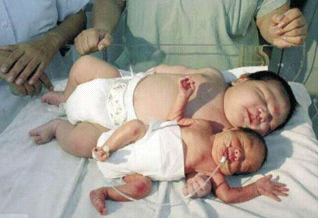 Mẹ sinh con gầy gò nhìn em bé béo tròn giường kế bên mà thèm khát, mẹ chồng nói một câu khiến cô con dâu tròn mắt kinh ngạc-3