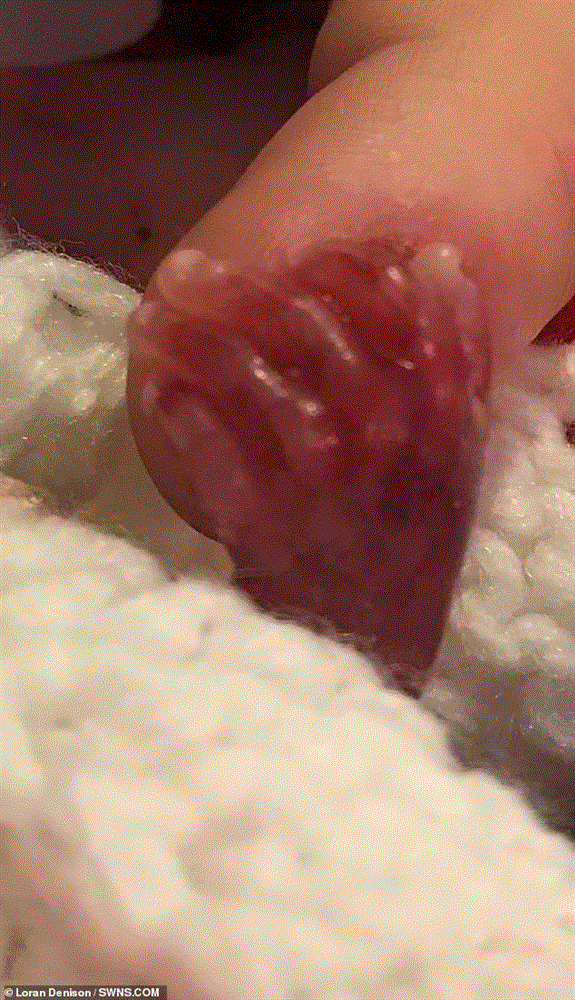 Uống thuốc phá thai lúc bầu 18 tuần, mẹ bất ngờ khi thai vẫn còn sống, nhìn con chào đời mà tột cùng hối hận-3