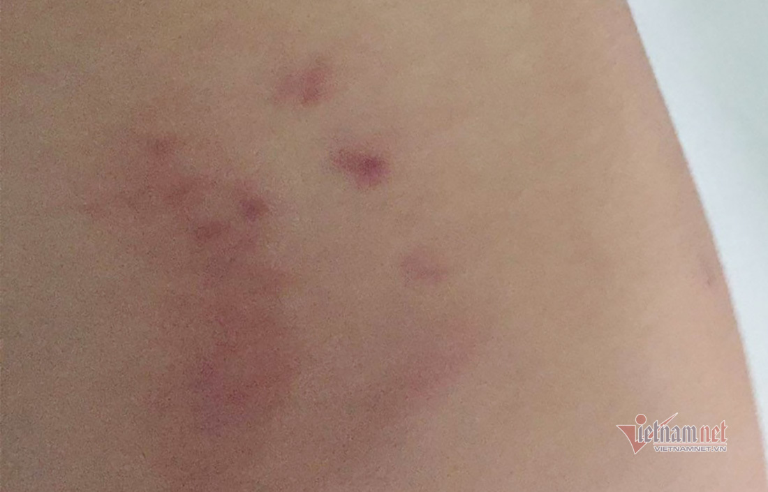 Học sinh lớp 3 bị mẹ của bạn đến tận nhà tát vào mặt-2