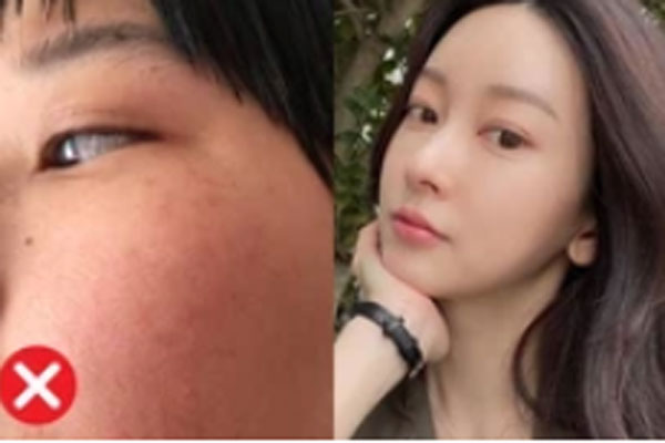 Đánh bay thâm nám như Phan Như Thảo, HHen Niê chỉ từ nguyên liệu rẻ bèo-11