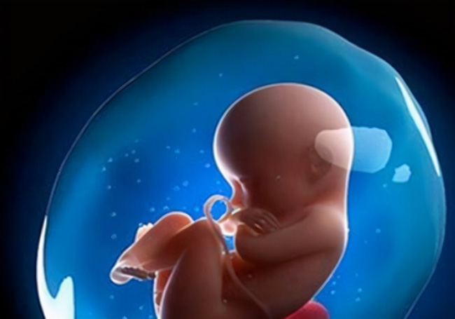 Vừa nhìn con chào đời, ông bố sợ tái mặt không dám bế nhưng bác sĩ liền chúc mừng điều may mắn hiếm có-2