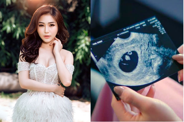 Hương Tràm chính thức lộ diện sau khi khoe ảnh siêu âm ngầm xác nhận mang thai ở Mỹ-6