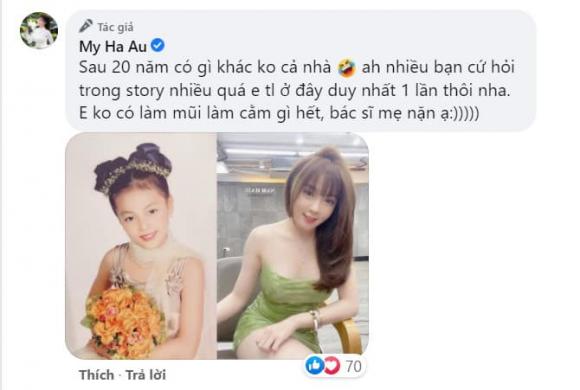 Bị đồn phẫu thuật thẩm mỹ, giảng viên hot girl Âu Hà My nói gì?-6