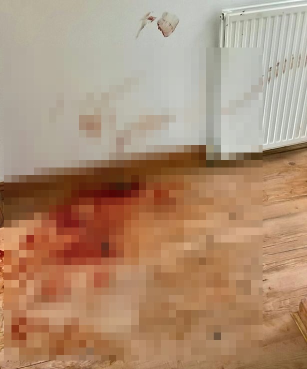 Phấn khởi lấy được người chồng tử tế sau một lần đổ vỡ, người phụ nữ sốc nặng khi biết bản chất thật của gã sau trận đòn thừa sống thiếu chết-3