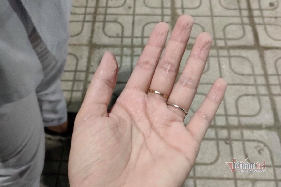 7 tiếng không ngơi nghỉ của thầy trò trường y tại điểm nóng Bắc Giang-2