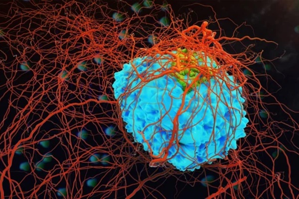 Ai cũng có tế bào ung thư trong cơ thể: Nhưng chỉ có 7 kiểu người có thể kích hoạt ung thư, khả năng mắc bệnh cao hơn hẳn người khác-1