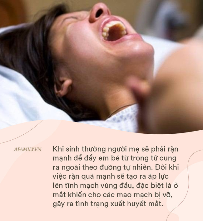 Hân hoan vì được lên chức bố nhưng mỗi lần nhìn vào mắt vợ, chồng lại xót xa vì di chứng của sinh nở-5