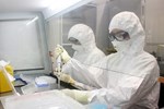 Australia tìm ra cách tiêu diệt 99,9% virus SARS-CoV-2 trong phổi bệnh nhân-2