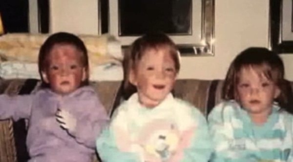 Chị em sinh ba bị bỏng kinh hoàng trong vụ cháy lớn hơn 30 năm trước, diện mạo xinh đẹp và cuộc sống ở hiện tại gây ngỡ ngàng vô cùng-4