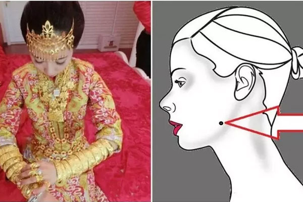 Vị trí vàng của nốt ruồi tài lộc, dự báo cả đời ăn không hết của-1