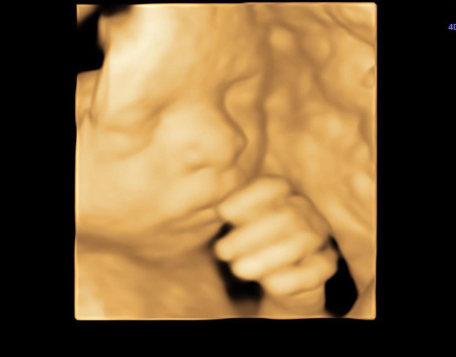 Lấy chồng Ấn Độ, Võ Hạ Trâm cứ nghĩ sẽ đẻ con lai xinh đẹp lắm, ngờ đâu nhìn ảnh siêu âm thì kết luận 1 câu: Hiếm có khó tìm-1