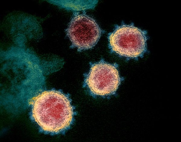 Virus SARS-CoV-2 lây truyền trong không khí: Đứng cách người bị nhiễm 10m vẫn bị lây?-1
