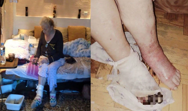 Cụ ông bị đau chân đến phòng khám tư kiểm tra và được chỉ định cưa chân, phẫu thuật xong bác sĩ cúi rạp xin lỗi vì lý do trời ơi đất hỡi-3