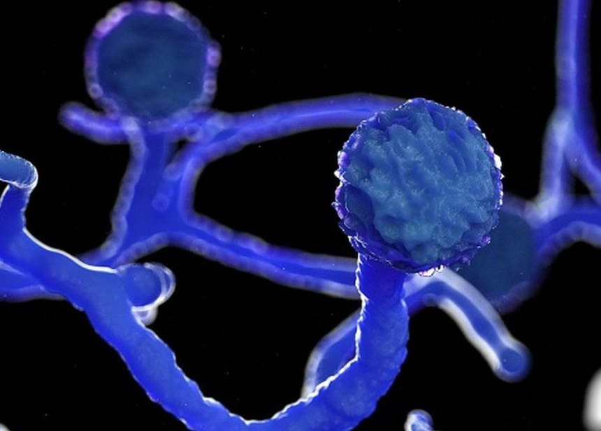 Ấn Độ cảnh báo dịch bệnh nấm đen nguy hiểm-1