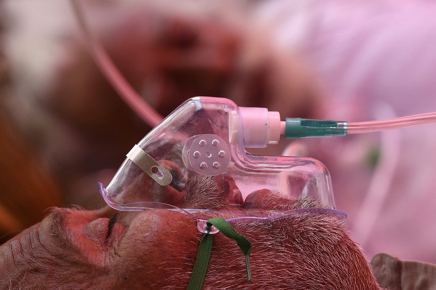 Ấn Độ cảnh báo dịch bệnh nấm đen nguy hiểm-3