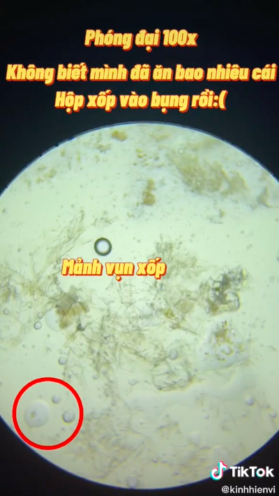 Sự thật rùng mình khi soi hộp xốp đựng đồ ăn dưới kính hiển vi: Chuyên gia cảnh báo dùng nhiều coi chừng gây vô sinh, dậy thì sớm và ung thư-1