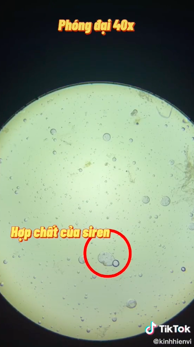 Sự thật rùng mình khi soi hộp xốp đựng đồ ăn dưới kính hiển vi: Chuyên gia cảnh báo dùng nhiều coi chừng gây vô sinh, dậy thì sớm và ung thư-3